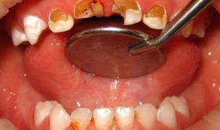 新生儿奶瓶 新生儿奶瓶